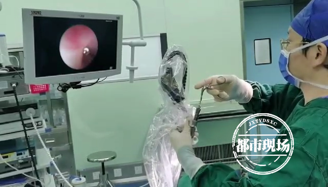 8月24日,江西上饶的徐女士带着11岁的儿子来到江西省儿童医院,让医生