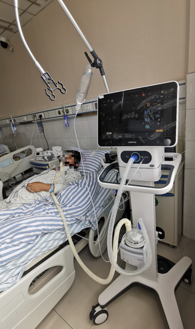 迈瑞推首款无创呼吸机 差异化创新助普及呼吸治疗技术