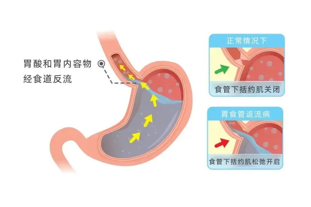 求医问病网_求医问药的app_求医问药在线咨询胃底间质瘤