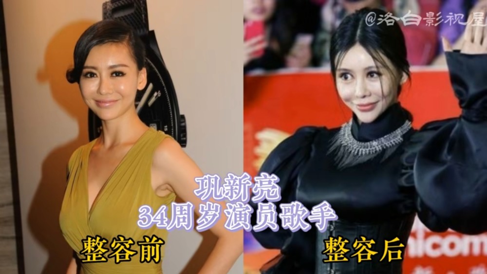 盘点女明星整容前后对比哪位你最熟悉哪位你印象最深刻