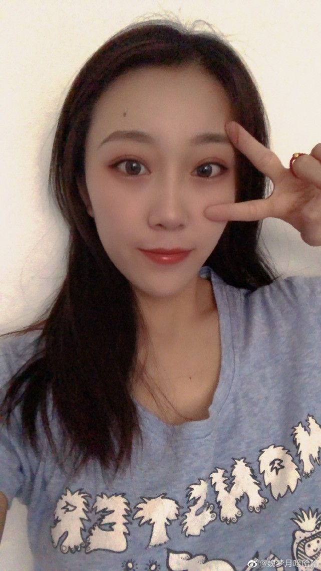 载誉回国后,魏梦月训练时不慎膝关节受伤,因此休养恢复了一年时间.