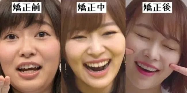 单眼皮、泪沟、凸嘴、方腮等，才是“小美女”的重中之重