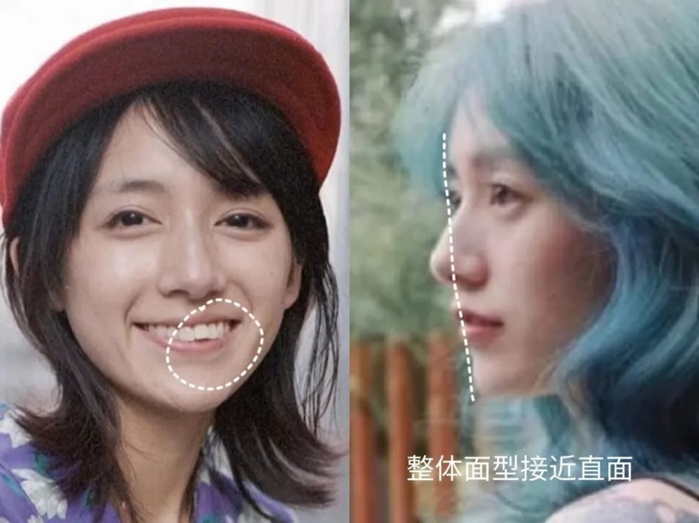 单眼皮、泪沟、凸嘴、方腮等，才是“小美女”的重中之重