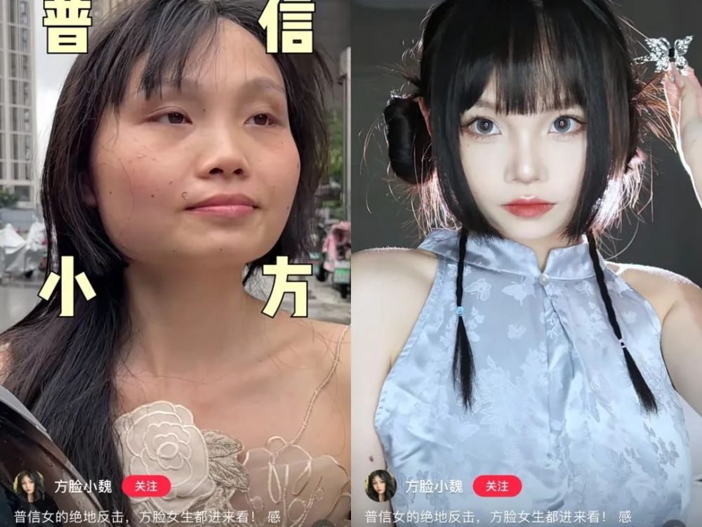 单眼皮、泪沟、凸嘴、方腮等，才是“小美女”的重中之重