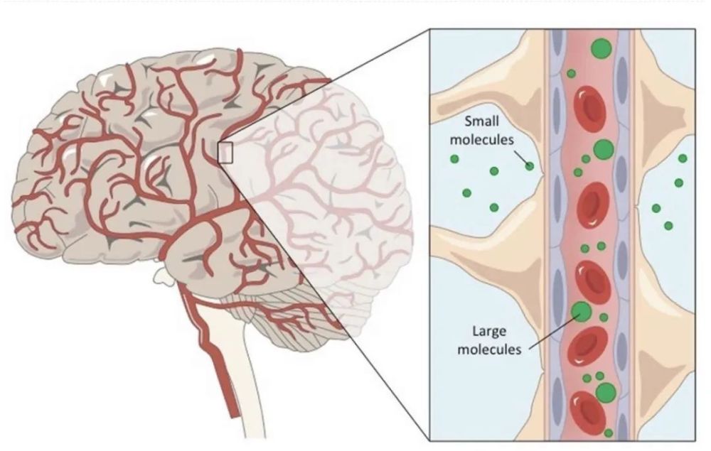 血脑屏障受损图片