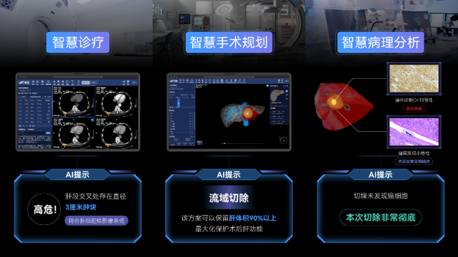 《“未来医院”触手可及，智慧医疗新模式让高精尖AI医疗普惠基层》