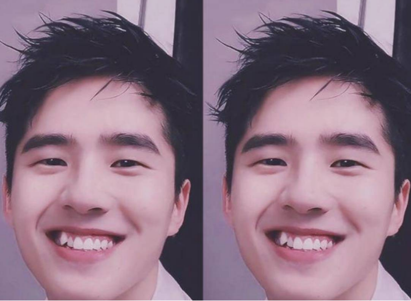 这些牙有缺陷,也坚持不整的明星才是真聪明_腾讯新闻