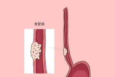 《clinical cancer research》|新型dna甲基化生物标志