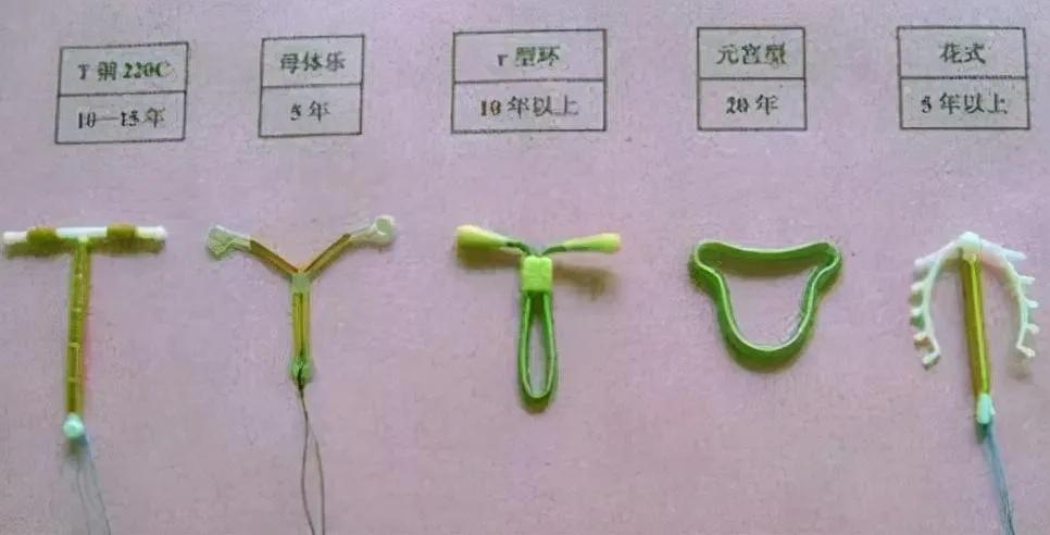 节育环能否终身不取_腾讯新闻