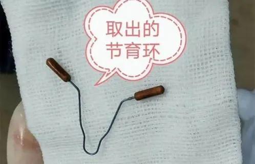 节育环能否终身不取