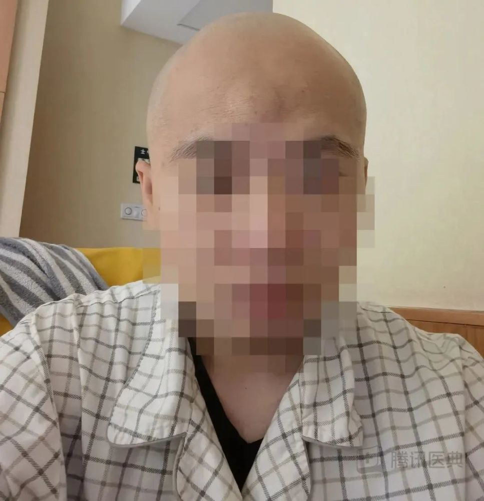 掀开头皮,挺过7小时手术,我终于治好了"头上的包"_腾讯新闻