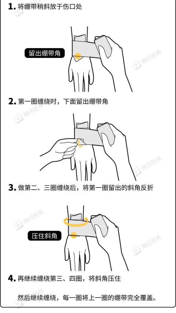 四肢包扎法图片