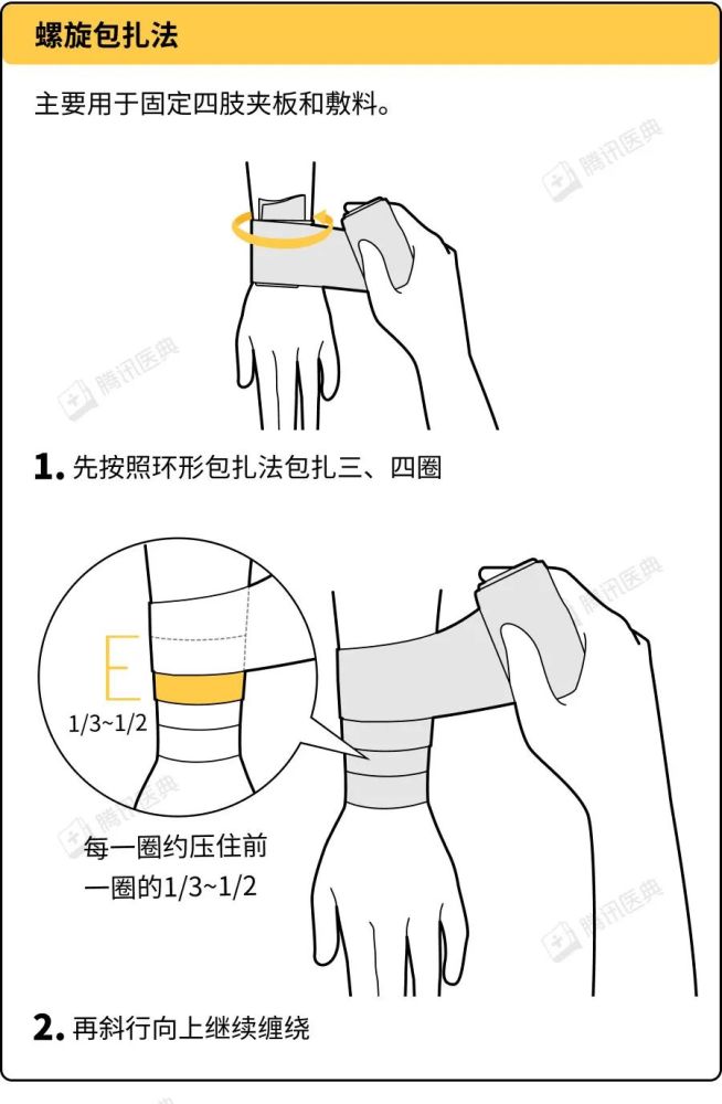 环形包扎法图解图片