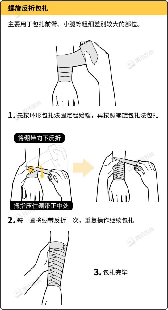 外伤处理中超实用的5种绷带包扎法赶紧学起来