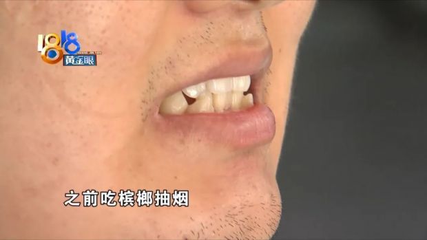 (亲戚嚼不嚼槟榔?)也嚼.(他们牙齿怎么样?)也不好,基本上嚼