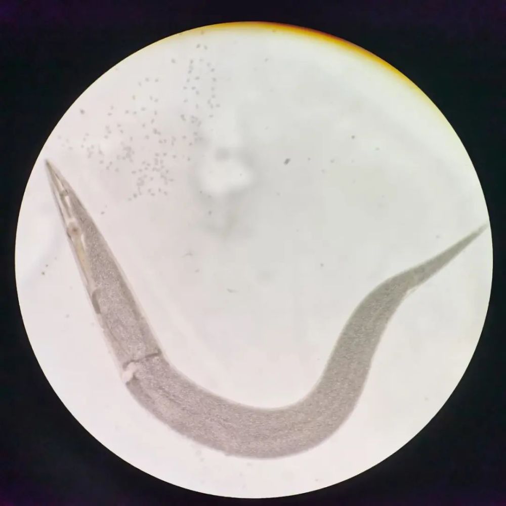 图1 盐水涂片形态上考虑蛲虫卵,是雌性蛲虫(见图7~9)