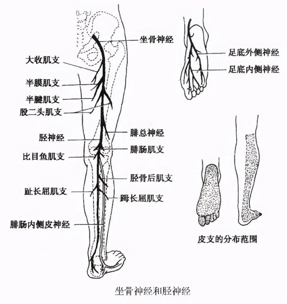 青壮年不明原因腰臀腿痛坐骨神经受累小心腰椎间盘突出症