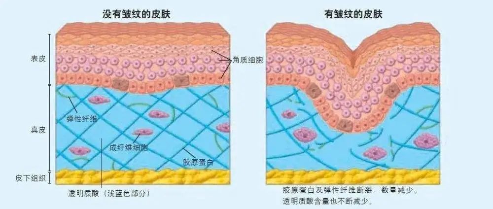 膠原纖維彈力纖維對皮膚抗老有什麼作用呢