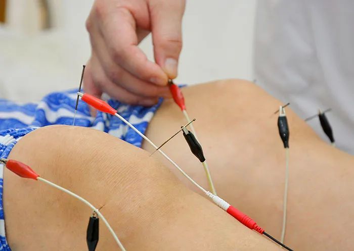 【人物】妙手回春的针灸名医/434701230985077535