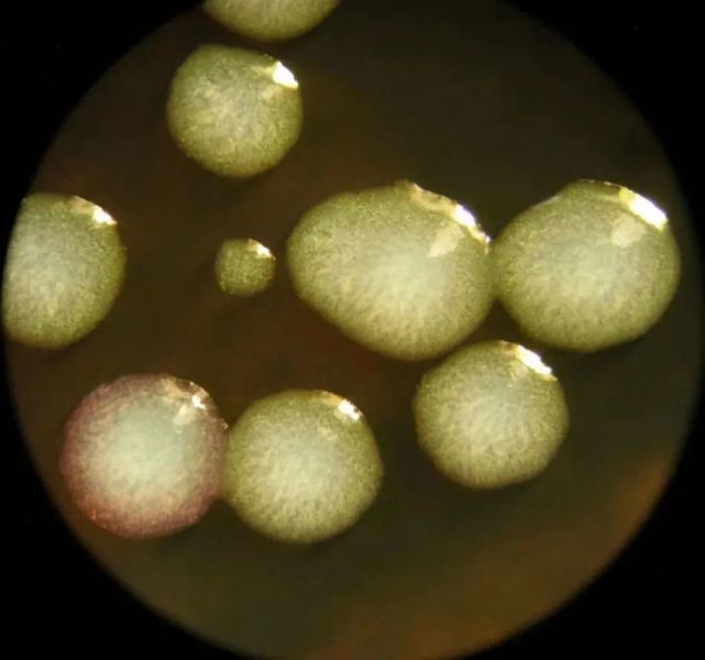 bcyeα琼脂72h(显微镜下菌落特征×40)(3)抗原抗体检测军团菌血清抗体