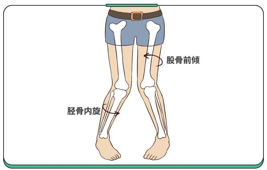 宝宝爱w坐是天性但超过这个年龄不改可能驼背x型腿