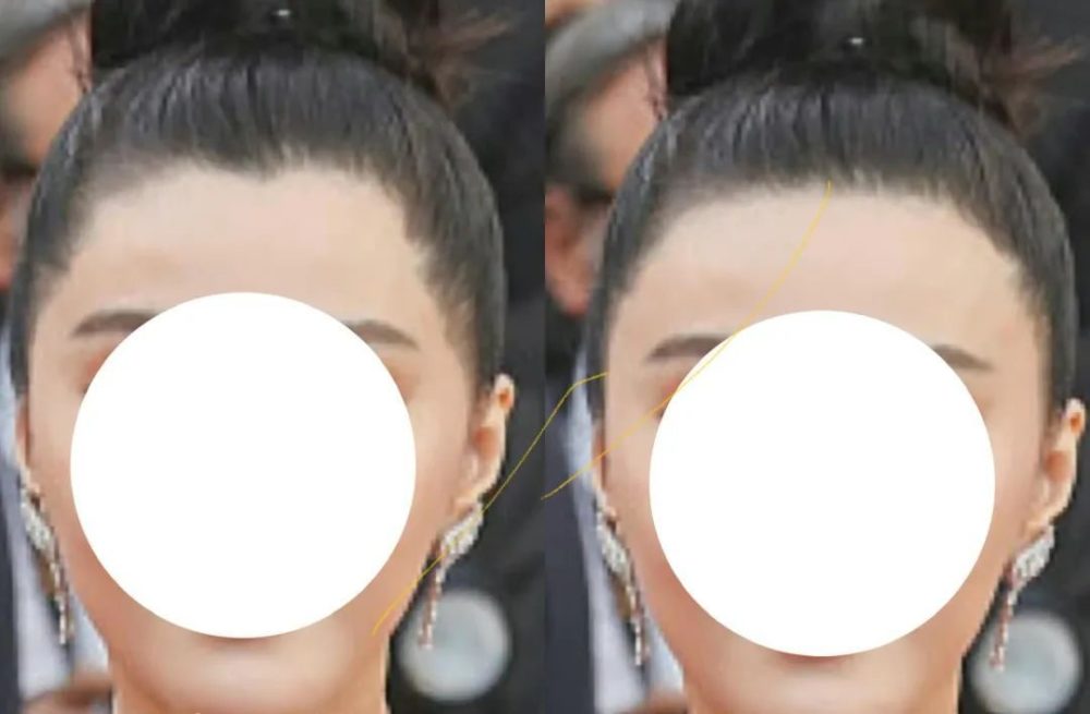 发际线就是这样,美的时候无人在意,但如果丑一点,就会很醒目插图36