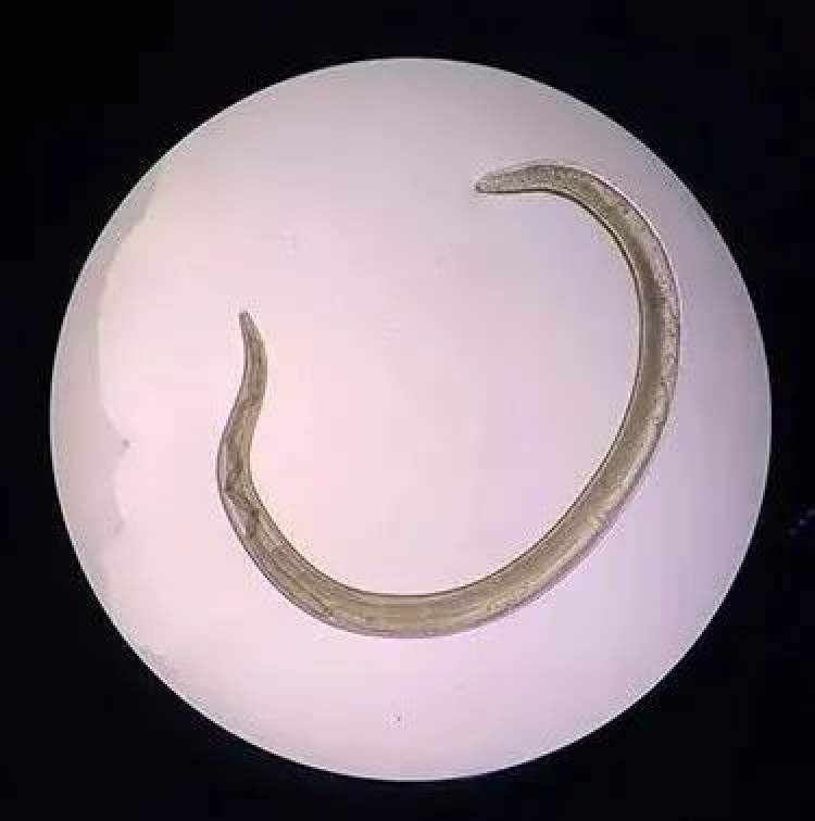 结膜吸吮线虫幼虫图片