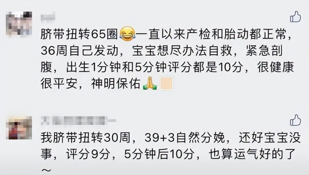 孕34周宝宝脐带扭转37圈紧急剖出 这事比脐带绕颈危险1000倍 腾讯新闻