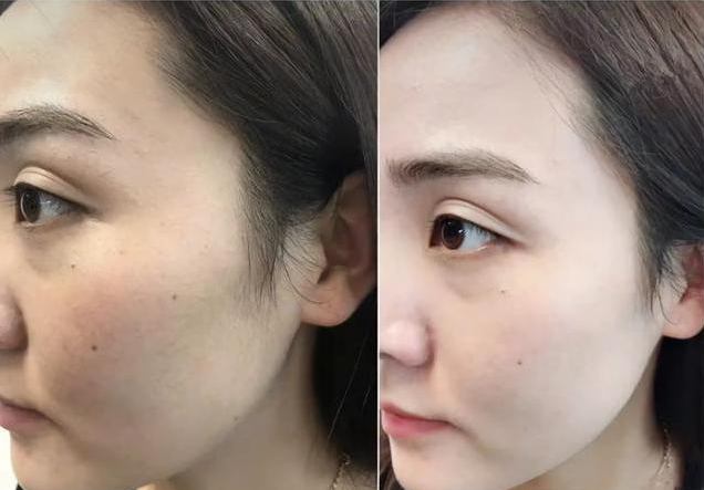 美白淡斑效果好的护肤品有哪些?排行前十名中口碑最好的三款!