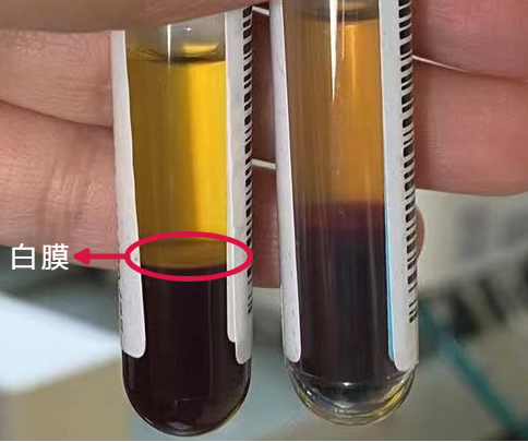 图5 血液样本性状案例总结通过本次案例让我更深刻意识到检验前质量