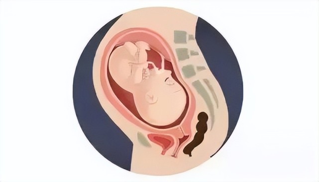 我们说说最常见的三种:我们都知道,在整个怀孕期间,宝宝会在子宫里
