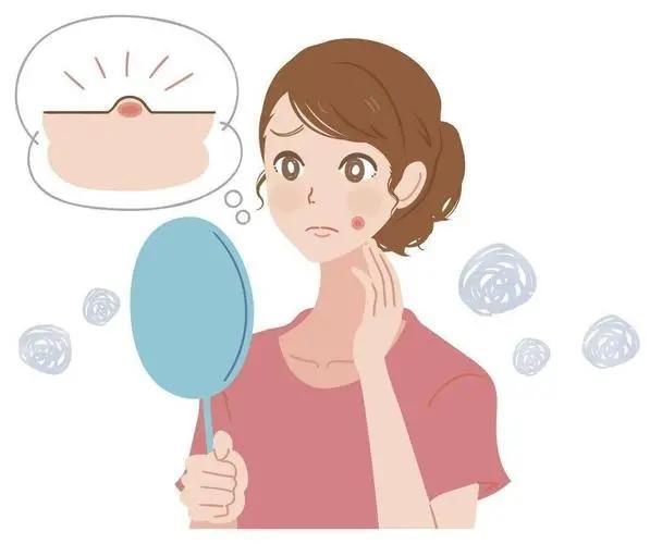 昆明皮肤管理中心:痘坑形成的原因?痘痘管理要多久才能见效?插图1