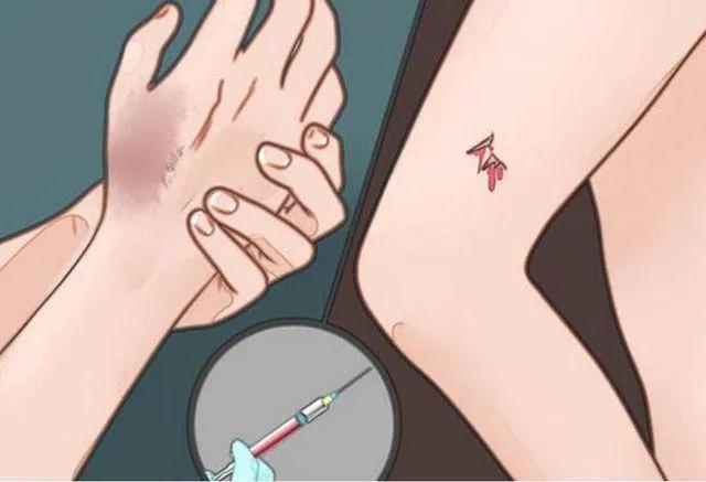 破伤风有多严重?