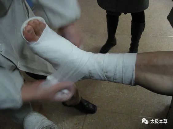 骨折，咱老百姓有验方和食疗方
