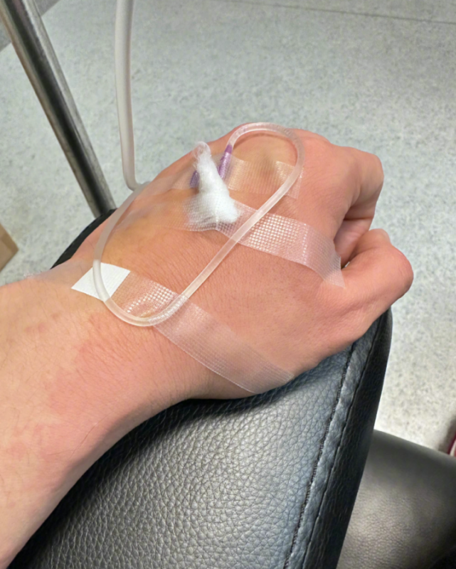 手臂大片红肿太吓人,晒吊水照引心疼_腾讯新闻