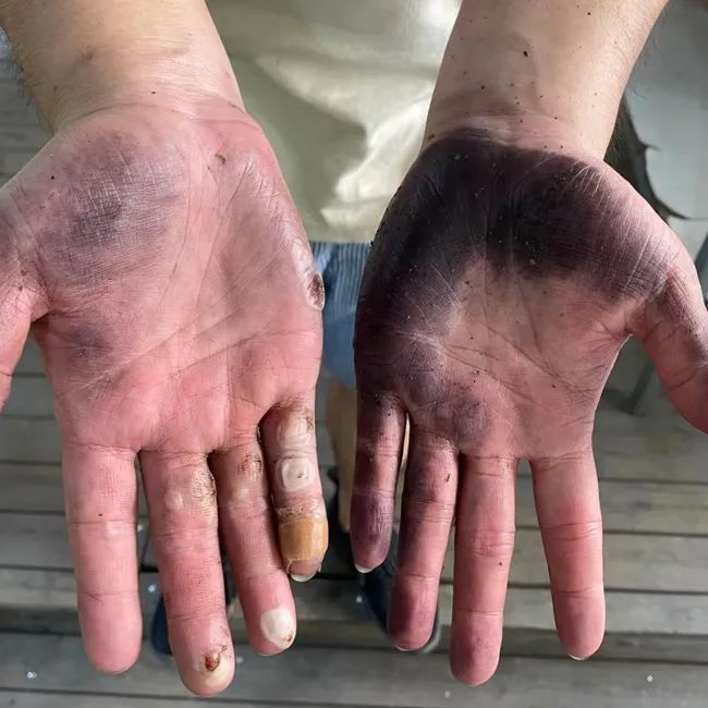 杭州海归女硕士练成铁砂掌:太卷了!