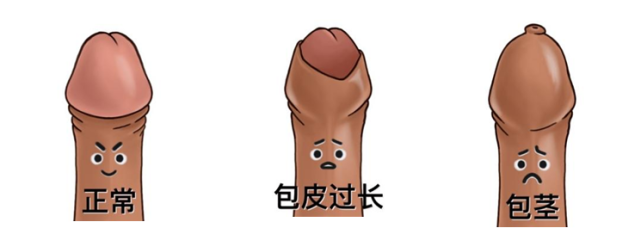 小男孩包茎的那些事,宝爸宝妈们要重视噢