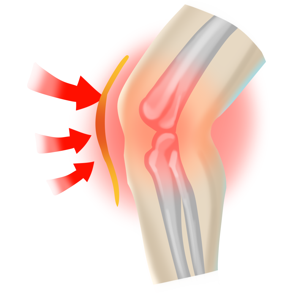 世界关节炎日 四点自测 五招预防 六件小事 带你认识关节炎 腾讯新闻