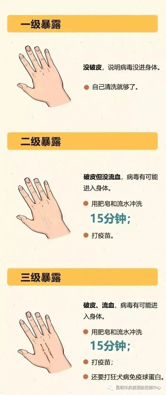 快收藏昆明最新狂犬病暴露预防处置门诊名单来了