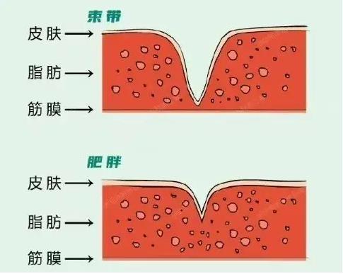 雲南夫婦喜得雙胞胎不料同胞不同命只因束帶綜合徵