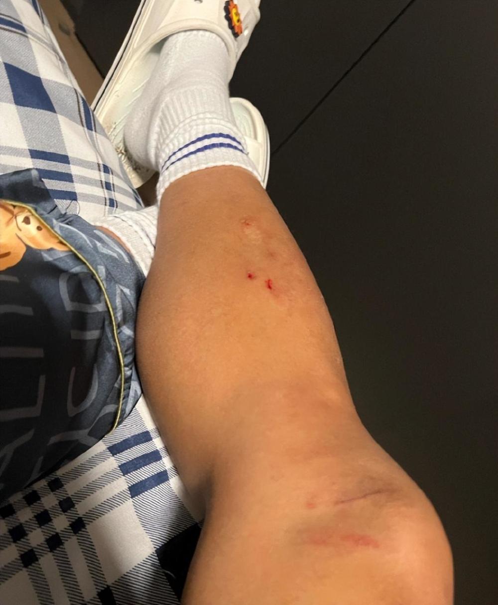 每次进球都不容易张琳艳瑞超再收1球1助拼烂球袜小腿受伤