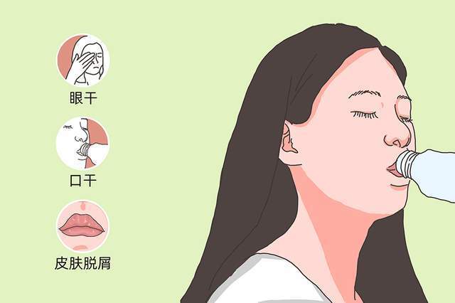 口干严重者可出现猖獗性龋齿.眼干严重者可出现"痛哭无泪"的现象.