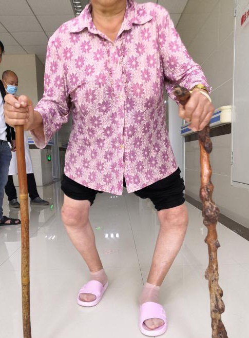 文山六旬老人7年拄拐艰难行走,结果……_腾讯新闻