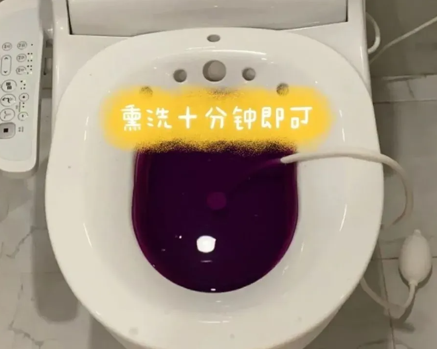 起初非常疼痛的时候,可以每天用高锰酸钾坐浴,后期只用温水坐浴就可以