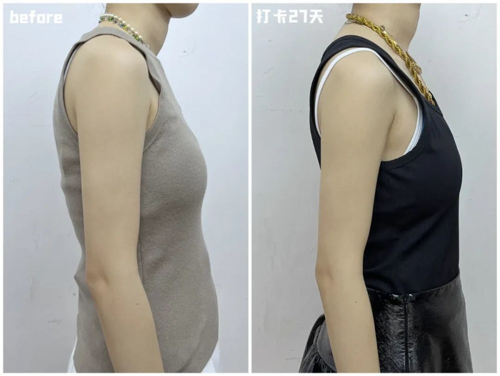 大家的体态也有改善,先来几组对比图.