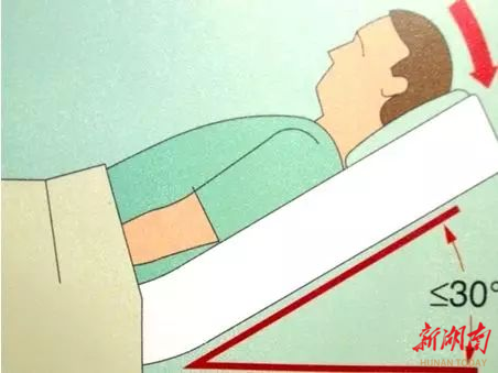 方法,翻身频率应个性化,一般是每两小时翻身一次,可采取30°斜侧卧位