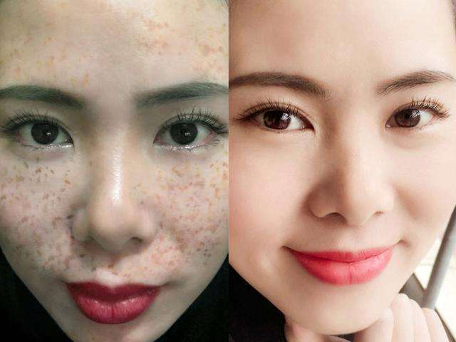 淡斑美白的产品哪一款最好,推荐比较好的美白淡斑产品_腾讯新闻