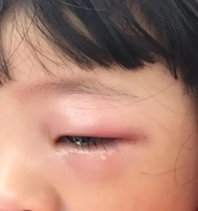 白细胞无法分类,检验人来揭秘_腾讯新闻