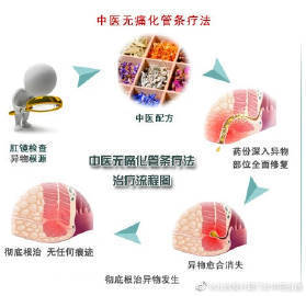 魔兽争霸3：天秀杯赛制改动后，Happy的战绩能被改写吗？国家玮怎么样