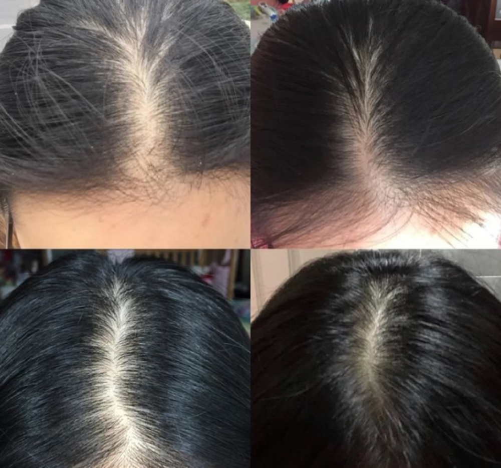 亲测有效的生发好物!一个月头发蹭蹭往出冒,国产就是牛!-cw资讯网